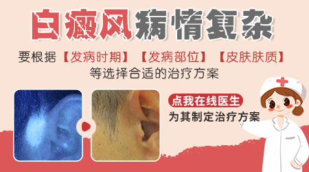 男性白癜风初期症状表现有哪些