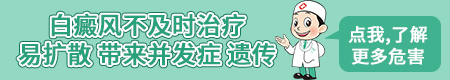 儿童白癜风,治疗希望大吗?”