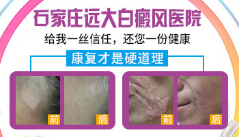 一个月大的孩子胸前长了白点怎么回事