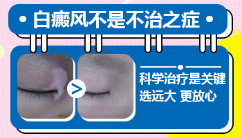 白癜风患者心理调适的温馨小贴士”
