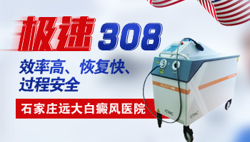 小孩白癜风扩散难控制，激素药物是解决方案吗？”