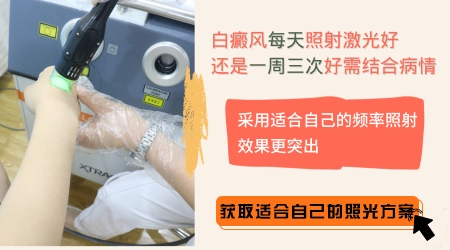 探究白癜风黑色素种植的费用:真的贵吗?