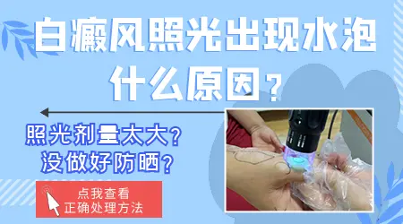 孩子吃药治白癜风,这些潜在危害你知道吗?”