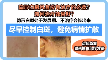 白癜风的心理治疗:理解与关爱同行
