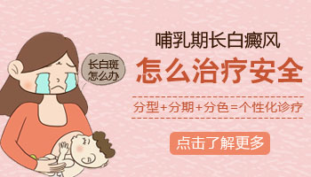 白癜风怎么治疗康复效果好