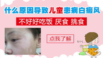 13岁孩子身上有黄豆粒大小白斑的治疗方法