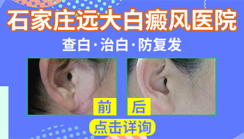`孩子脖子上出现白色圆圈,家长别急,先看看这些可能的原因`