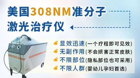 男性为何会担心白癜风难以治愈?”