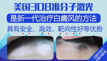 孕期白癜风患者能否安全使用308光疗机?”