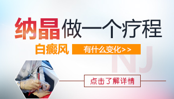 女性朋友长白癜风不治疗可以吗？”