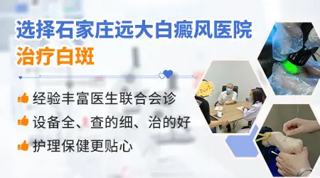白癜风什么时候做植皮成功几率高