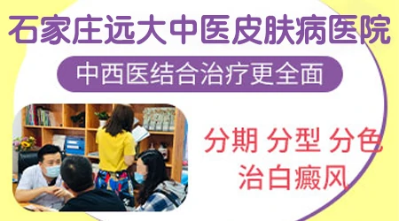 儿童白癜风治疗时,这些禁忌事项需牢记!”