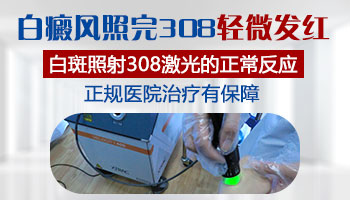 孩子嘴巴右下角长白斑是什么?家长需知的常见原因与应对方法