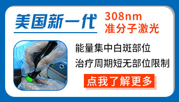 吸烟对男性白癜风有哪些危害？”