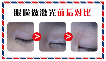 刚生完小孩能治疗白癜风吗”