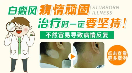小孩吃中药治白癜风,对身体会不会有不良影响?”