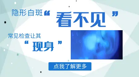 白癜风做光疗不吃药可以吗？