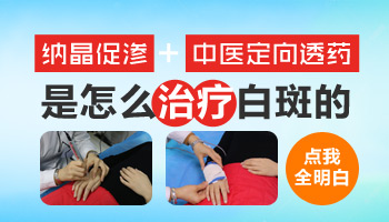 `儿童白癜风通常会在哪些部位出现?`