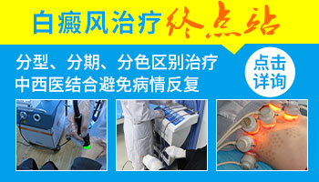 两岁半小孩脸上和手上白癜风的治疗方法”