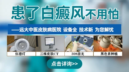 `白癜风患者的心理：理解与关爱同样重要`