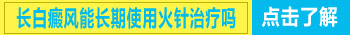 女性白癜风治疗什么方法好”