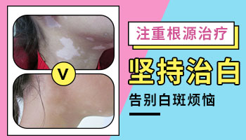 7岁孩子手指白癜风治疗指南:如何有效促进康复”