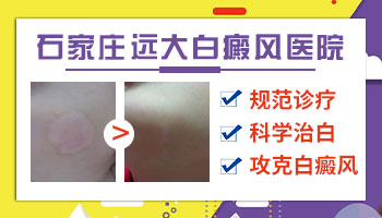 怀孕期间身上长白点是怎么回事”