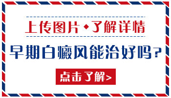 小孩面部白癜风,哪些治疗方法温和又有效?