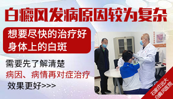 儿童白癜风激光治疗,多少次能看到效果?”