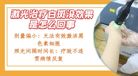 孕妇白癜风发展期，如何有效管理与控制？”