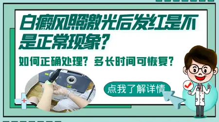 白癜风耐光后怎么办？如何继续有效治疗白癜风”