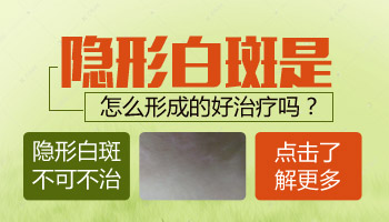 宝宝出生自带白斑,这是白癜风的症状吗?