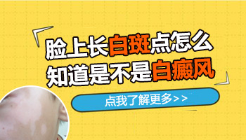 女性身上长白癜风为什么？详解原因与应对方法