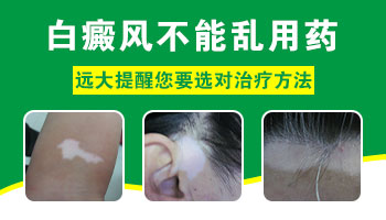 孩子面部白癜风,治疗难不难?”