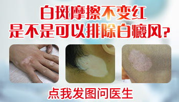 男性脖子白癜风一年了扩散了怎么治疗”