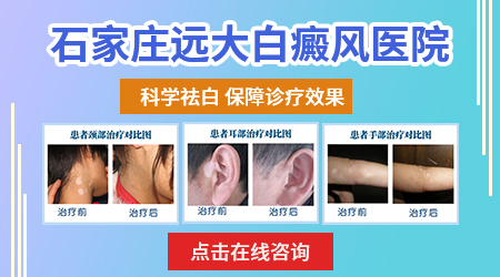 小孩做伍德灯检查阳性能治好吗