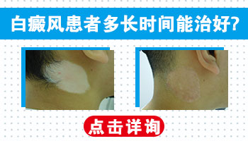 孩子胸前白斑逐渐明显,家长需关注的变化”