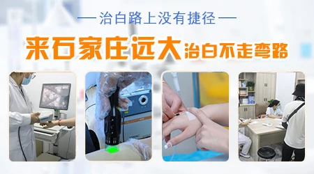 儿童发展期白癜风通常发病因素有哪些?”