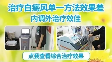 孩子白癜风已一年,还能恢复健康吗?”