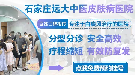 儿童白癜风只吃药能看好吗?”