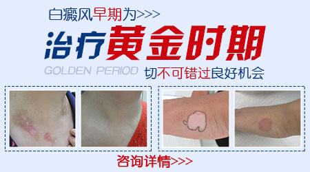 白癜风患者怎样做才能减少外在有害物质的伤害？”