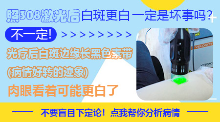 `这两种佳品搭配着吃，竟可能影响健康？`