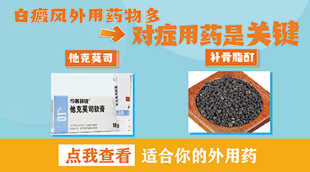 孕妇采用光疗治疗白癜风，效果究竟如何？