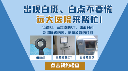 女性白癜风患者面对含激素药物该怎么办？