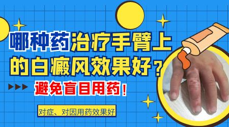`如何有效治疗儿童白癜风?`