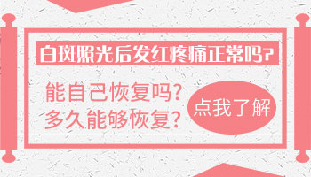 为儿童白癜风挑选最佳治疗方案，看这里就够了！