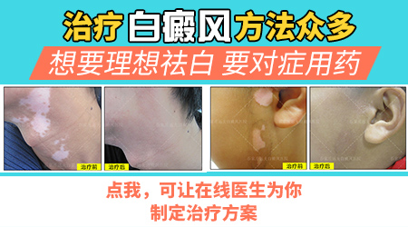 最近发现女儿脸上一片白皮肤怎么回事?”