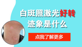女性白癜风患者，如何加速康复进程？