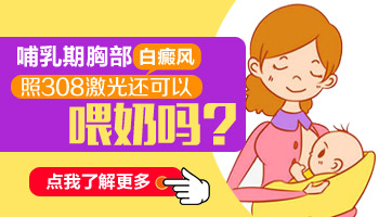 白癜风怎么治疗好？专业解析与综合治疗策略”