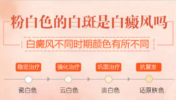 白癜风孕妇患者治疗时需关注的几大注意事项